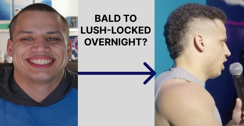 Tyler1’s Hair Transplant: Did the Infamous Streamer Get a Secret Hair Transplant in Turkey?